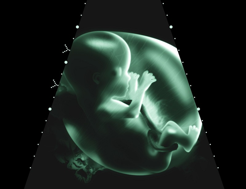 ultraschall baby schwangerschaft ssw foetus foetus